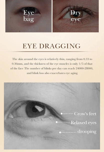 SADOER Caviar Collagen Eye Cream Anti Dark Circles Removal